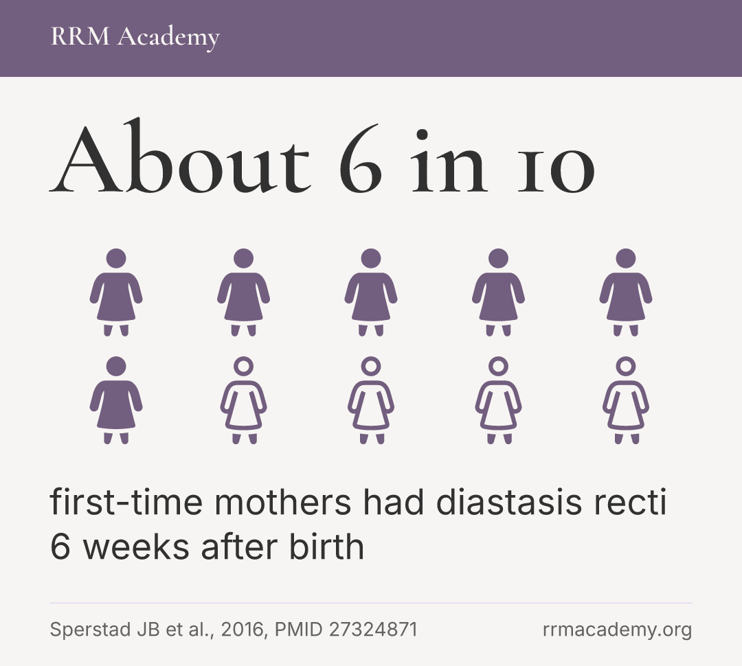 About 6 in 10 first-time mothers had diastasis recti 6 weeks after birth